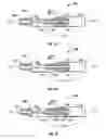 Fig. 10 - Multiple member interconnect for surgical instrument and absorbable screw fastener