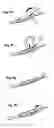Fig. 07 - Bone fixation device for surgical operation, cutting device and band head for the same