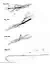 Fig. 09 - Bone fixation device for surgical operation, cutting device and band head for the same