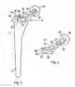 Fig. 02 - Hip stem instrument with releasable connection