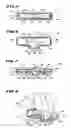Fig. 04 - Slip-fit handle for hand-held instruments that access interior body regions