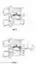 Fig. 04 - Revision methods for a vertebral device
