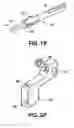 Fig. 04 - Instruments for minimally invasive surgery total knee arthroplasty