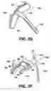 Fig. 06 - Instruments for minimally invasive surgery total knee arthroplasty