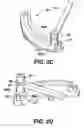 Fig. 07 - Instruments for minimally invasive surgery total knee arthroplasty