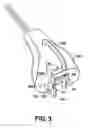 Fig. 08 - Instruments for minimally invasive surgery total knee arthroplasty