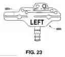 Fig. 33 - Instruments for minimally invasive surgery total knee arthroplasty