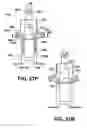 Fig. 41 - Instruments for minimally invasive surgery total knee arthroplasty