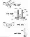 Fig. 47 - Instruments for minimally invasive surgery total knee arthroplasty