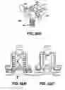 Fig. 49 - Instruments for minimally invasive surgery total knee arthroplasty