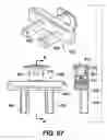 Fig. 55 - Instruments for minimally invasive surgery total knee arthroplasty