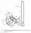 Fig. 03 - Prosthetic revision knee system