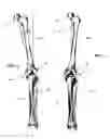Fig. 02 - Method and apparatus for achieving correct limb alignment in unicondylar knee arthroplasty