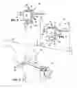 Fig. 04 - Method and apparatus for achieving correct limb alignment in unicondylar knee arthroplasty