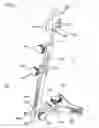 Fig. 02 - Unicondylar knee instrument system