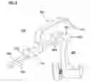 Fig. 06 - Unicondylar knee instrument system