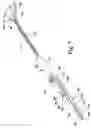 Fig. 06 - Methods and instrumentation for distraction and insertion of implants in a spinal disc space