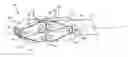 Fig. 01 - Minimally invasive expanding spacer and method