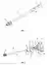 Fig. 04 - Minimally invasive expanding spacer and method
