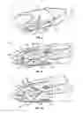 Fig. 06 - Minimally invasive expanding spacer and method
