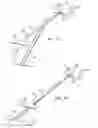 Fig. 04 - Screw extraction and insertion device