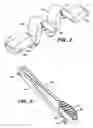 Fig. 06 - Methods and apparatus for delivery of ocular implants