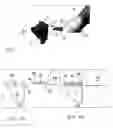 Fig. 02 - Surgical instrument combination