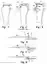 Fig. 02 - Method and apparatus for providing suture in a passageway
