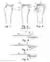 Fig. 02 - Method and apparatus for suture placement