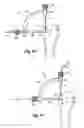 Fig. 04 - Method and apparatus for suture placement