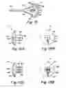 Fig. 06 - Method and apparatus for suture placement