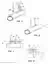 Fig. 03 - Anastomosis system with flexible shaft
