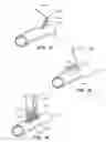 Fig. 07 - Anastomosis system with flexible shaft