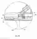 Fig. 20 - Anastomosis system with flexible shaft