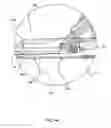 Fig. 22 - Anastomosis system with flexible shaft
