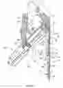 Fig. 23 - Anastomosis system with flexible shaft