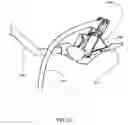 Fig. 48 - Anastomosis system with flexible shaft