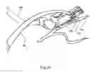 Fig. 49 - Anastomosis system with flexible shaft