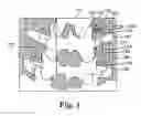 Fig. 02 - Surgical cutter
