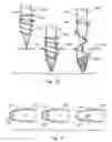 Fig. 07 - Tissue penetration device