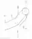 Fig. 22 - Subcision device
