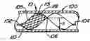 Fig. 01 - Endoluminal filter