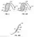 Fig. 09 - Endoluminal filter