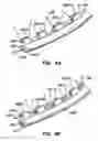 Fig. 22 - Endoluminal filter