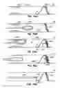 Fig. 43 - Endoluminal filter