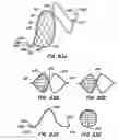 Fig. 47 - Endoluminal filter