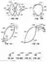 Fig. 07 - Lumen filtering methods