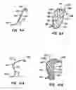 Fig. 08 - Lumen filtering methods