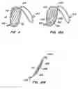 Fig. 09 - Lumen filtering methods