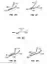 Fig. 16 - Lumen filtering methods